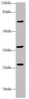 Glucosamine (N-Acetyl)-6-Sulfatase antibody, LS-C675822, Lifespan Biosciences, Western Blot image 