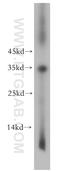 sTnT antibody, 15893-1-AP, Proteintech Group, Western Blot image 