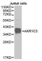 Aldo-Keto Reductase Family 1 Member C3 antibody, TA327176, Origene, Western Blot image 