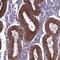 Coiled-Coil Domain Containing 84 antibody, HPA039906, Atlas Antibodies, Immunohistochemistry paraffin image 