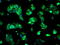 SDH antibody, GTX83589, GeneTex, Immunocytochemistry image 