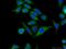 Rho GTPase Activating Protein 27 antibody, 22077-1-AP, Proteintech Group, Immunofluorescence image 