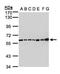 Complement C2 antibody, GTX105404, GeneTex, Western Blot image 