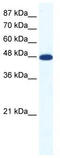 Acid Sensing Ion Channel Subunit Family Member 5 antibody, TA331464, Origene, Western Blot image 