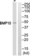 Bone morphogenetic protein 10 antibody, TA312728, Origene, Western Blot image 