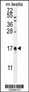 Calcium/Calmodulin Dependent Protein Kinase II Inhibitor 1 antibody, 55-101, ProSci, Western Blot image 