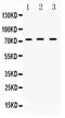 ATP Binding Cassette Subfamily G Member 8 antibody, PA5-78703, Invitrogen Antibodies, Western Blot image 