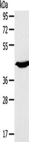 Potassium channel subfamily K member 3 antibody, TA351788, Origene, Western Blot image 
