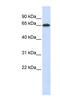 Frizzled Class Receptor 4 antibody, ARP41266_P050, Aviva Systems Biology, Western Blot image 