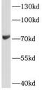 Lysyl Oxidase Like 1 antibody, FNab09975, FineTest, Western Blot image 