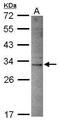 Deoxyribonuclease 2 Beta antibody, GTX119206, GeneTex, Western Blot image 