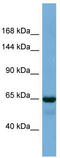 Polyhomeotic-like protein 1 antibody, TA339865, Origene, Western Blot image 