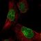 KIAA1586 antibody, NBP1-86291, Novus Biologicals, Immunofluorescence image 