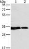Complex I intermediate-associated protein 30, mitochondrial antibody, PA5-50461, Invitrogen Antibodies, Western Blot image 