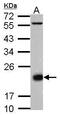 CD3d Molecule antibody, PA5-28313, Invitrogen Antibodies, Western Blot image 