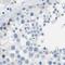 CD20 antibody, NBP1-90052, Novus Biologicals, Immunohistochemistry paraffin image 