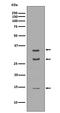 proBDNF antibody, M00035-1, Boster Biological Technology, Western Blot image 