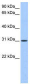 HUS1 Checkpoint Clamp Component B antibody, TA338812, Origene, Western Blot image 