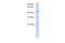 Sulfotransferase family cytosolic 2B member 1 antibody, 26-332, ProSci, Western Blot image 