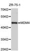 MDM4 Regulator Of P53 antibody, STJ111111, St John