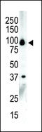 Protein Kinase D3 antibody, 62-600, ProSci, Western Blot image 