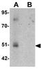 Forkhead Box D4 Like 1 antibody, GTX31468, GeneTex, Western Blot image 