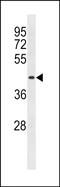 Solute Carrier Family 49 Member 4 antibody, PA5-49274, Invitrogen Antibodies, Western Blot image 