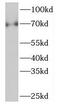 p75 ICD antibody, FNab06091, FineTest, Western Blot image 