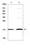 Epithelial Mitogen antibody, A10011-1, Boster Biological Technology, Western Blot image 