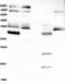 Clathrin Heavy Chain Linker Domain Containing 1 antibody, NBP1-91730, Novus Biologicals, Western Blot image 