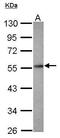 Protein Phosphatase 2 Regulatory Subunit Bdelta antibody, PA5-30763, Invitrogen Antibodies, Western Blot image 