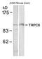 Transient Receptor Potential Cation Channel Subfamily C Member 6 antibody, GTX50636, GeneTex, Western Blot image 