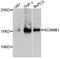 Potassium Calcium-Activated Channel Subfamily M Regulatory Beta Subunit 1 antibody, abx126040, Abbexa, Western Blot image 