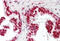 Cold Inducible RNA Binding Protein antibody, ARP40348_P050, Aviva Systems Biology, Immunohistochemistry paraffin image 