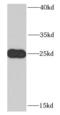 RNA Transcription, Translation And Transport Factor antibody, FNab01023, FineTest, Western Blot image 