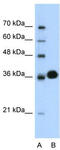 Cyclin Dependent Kinase 6 antibody, TA330350, Origene, Western Blot image 