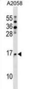 N(Alpha)-Acetyltransferase 20, NatB Catalytic Subunit antibody, abx028800, Abbexa, Western Blot image 