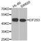 Eukaryotic Translation Initiation Factor 2 Subunit Gamma antibody, STJ28664, St John