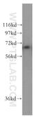 Protein kinase C iota type antibody, 13883-1-AP, Proteintech Group, Western Blot image 