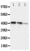 Discoidin Domain Receptor Tyrosine Kinase 2 antibody, PA5-79144, Invitrogen Antibodies, Western Blot image 
