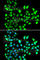 Small Nuclear Ribonucleoprotein D2 Polypeptide antibody, A6983, ABclonal Technology, Immunofluorescence image 