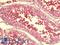 Spermatogenesis Associated 19 antibody, LS-B9605, Lifespan Biosciences, Immunohistochemistry paraffin image 