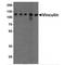 Vinculin antibody, TA349057, Origene, Western Blot image 