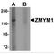 Zinc Finger MYM-Type Containing 1 antibody, MBS150156, MyBioSource, Western Blot image 