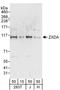 Zinc Finger X-Linked Duplicated A antibody, A303-656A, Bethyl Labs, Western Blot image 