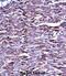 Matrix Metallopeptidase 15 antibody, abx027580, Abbexa, Immunohistochemistry frozen image 