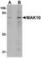 N(Alpha)-Acetyltransferase 35, NatC Auxiliary Subunit antibody, MBS150477, MyBioSource, Western Blot image 