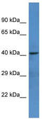 Netrin G1 antibody, TA342922, Origene, Western Blot image 