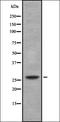 CCAAT Enhancer Binding Protein Delta antibody, orb378244, Biorbyt, Western Blot image 