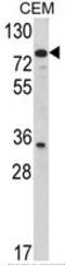 Protein-glutamine gamma-glutamyltransferase 4 antibody, AP17785PU-N, Origene, Western Blot image 